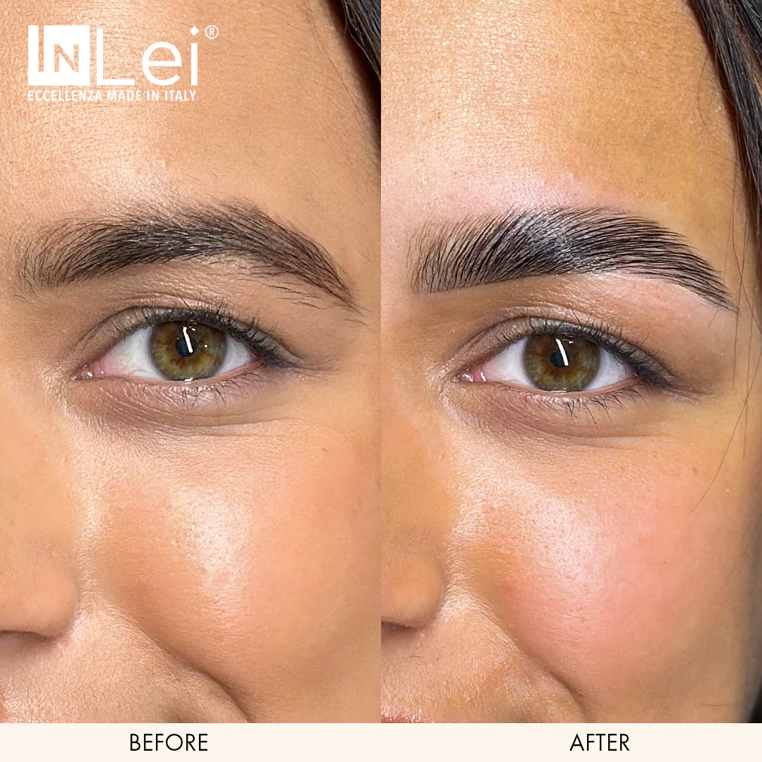 InLei® Brow Lift 1 - Image 3