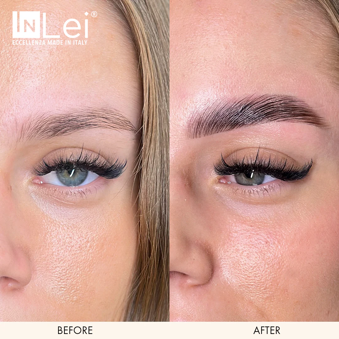 InLei® Brow Lift 1 - Image 5